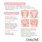 Chalone Adhesive Strapless Backless Bra